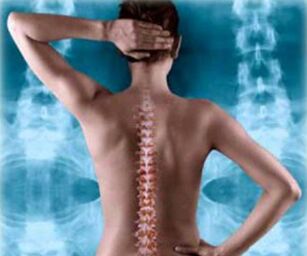 ilustrácia zadnej chrbtice