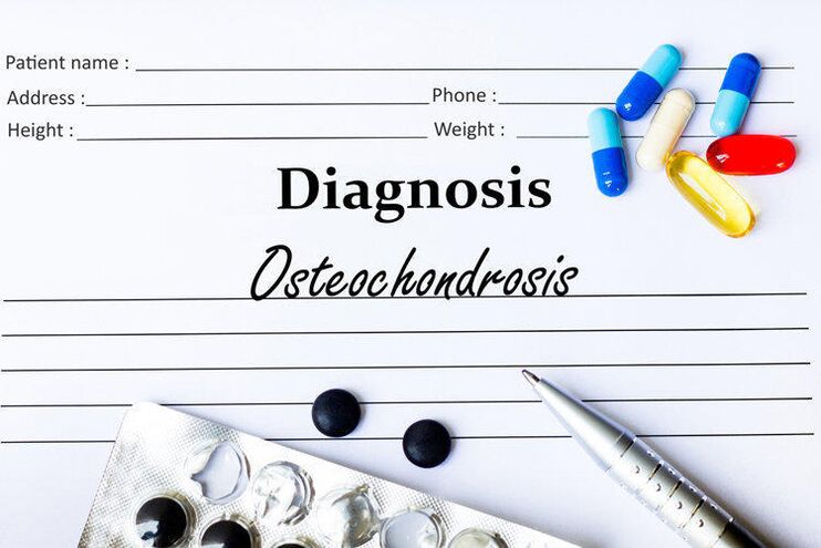 lieky na diagnostiku osteochondrózy