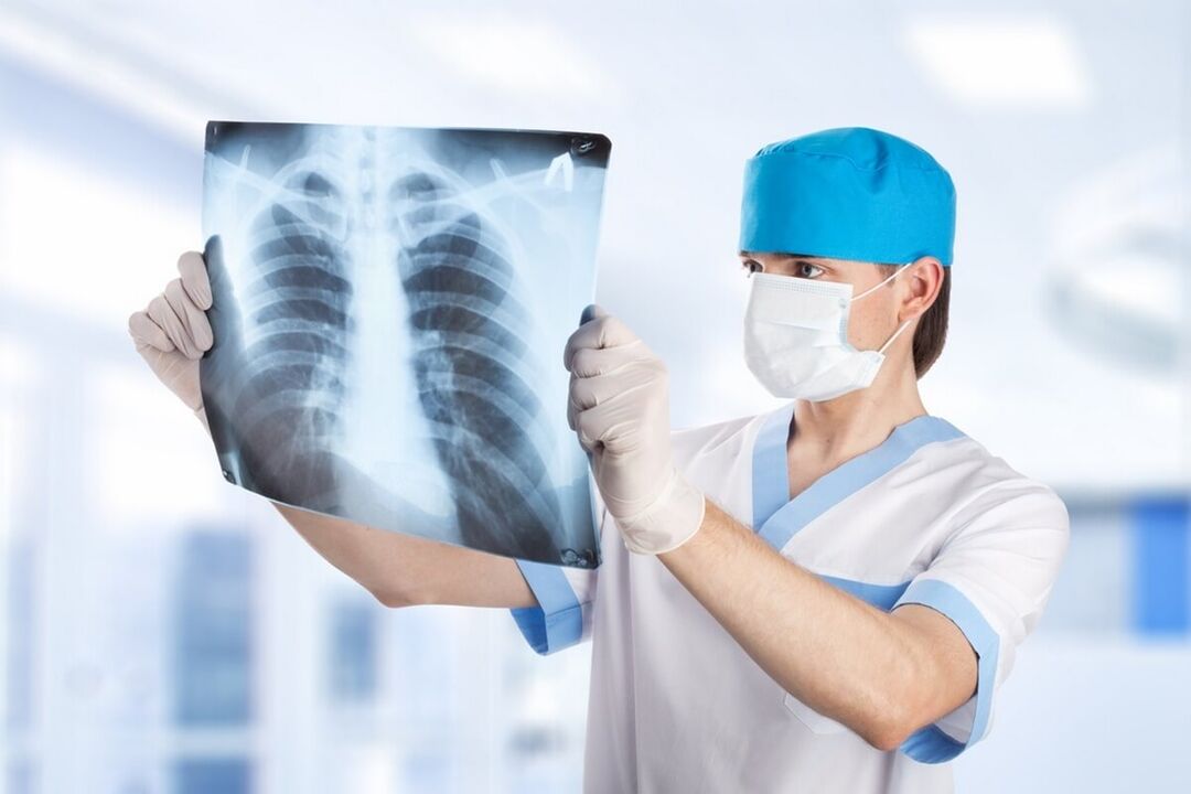 Röntgenové vyšetrenie hrudníka s osteochondrózou