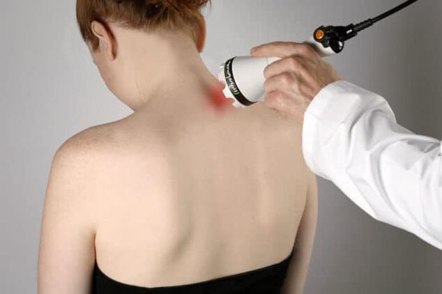 Laserová terapia sa používa na boj proti bolesti chrbta v oblasti lopatky. 