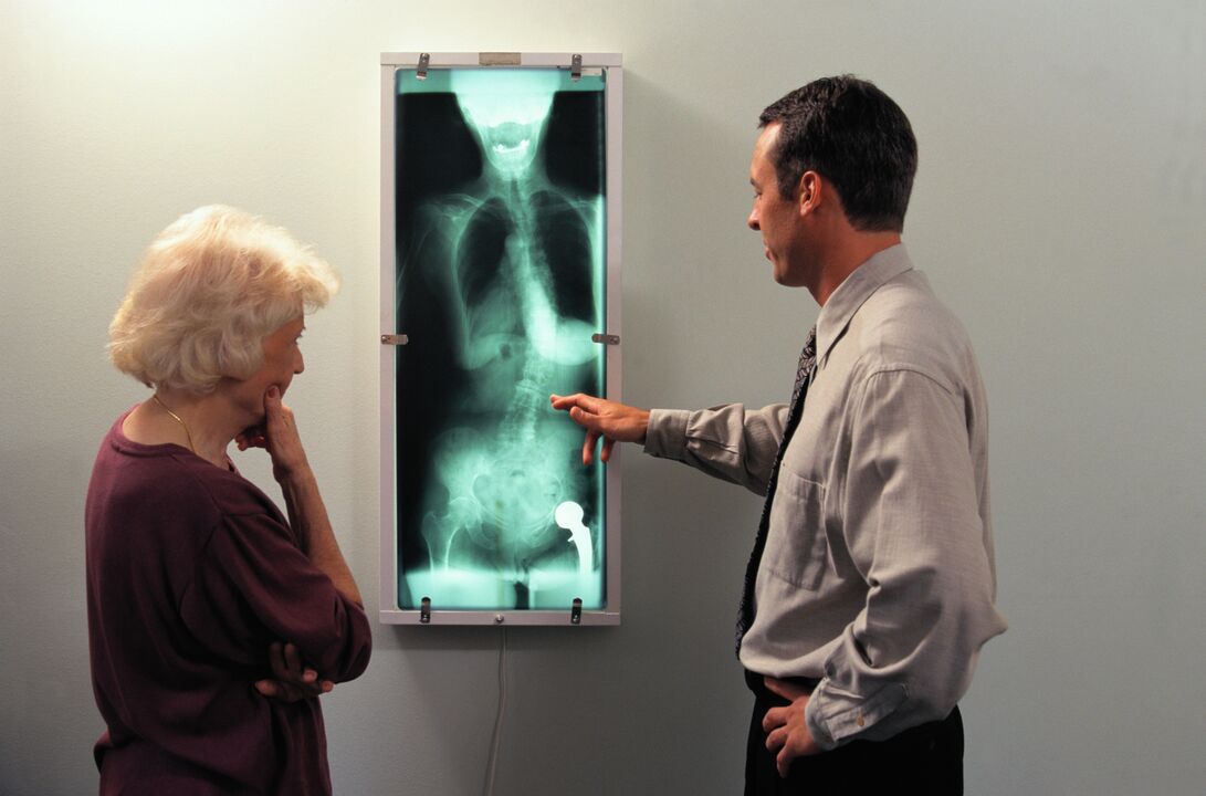 röntgenová diagnostika bolesti v bedrovom kĺbe