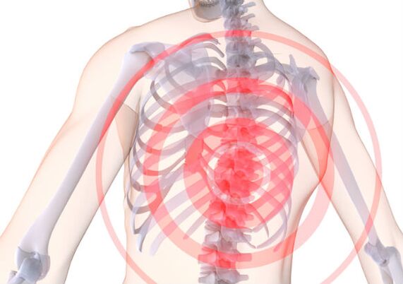 Hrudná chrbtica postihnutá osteochondrózou